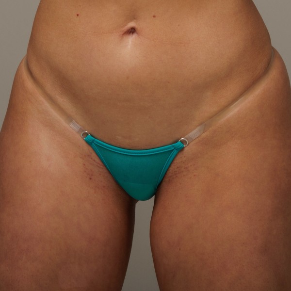 Silikon Emerald Transparent - Bikini String Tanga